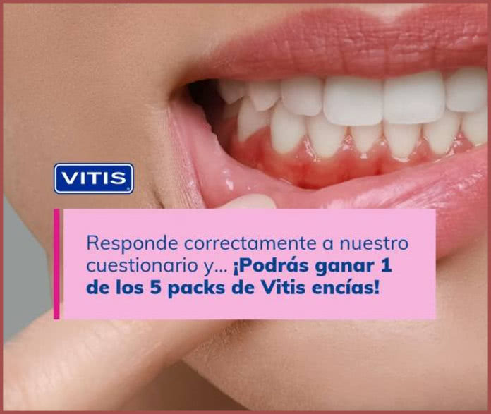 Sorteo Vitis 5 Kits Encías